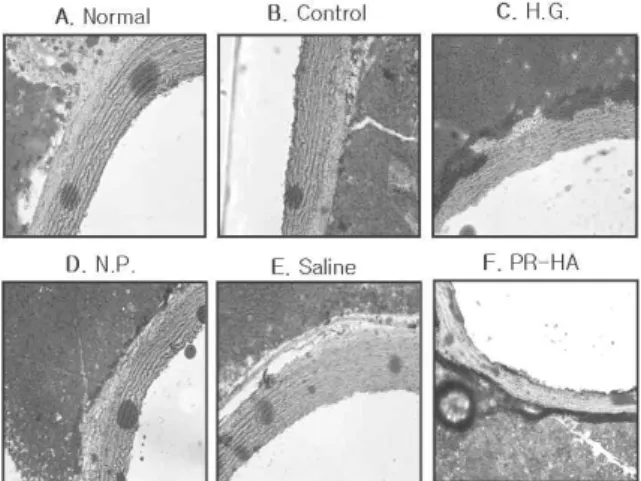 Fig. 13. Histological analysis of aorta in rats with hyperlipidemia(Oil red O stain)×200