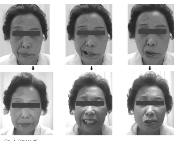 Fig.  4.  Patient  #3