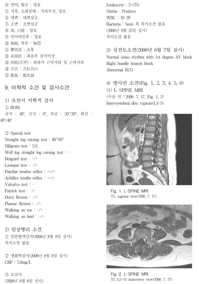 Fig.  1.  L-SPINE  MRI  T1,  sagittal  view(2008.  7.  17).