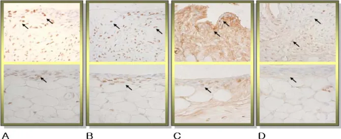 Fig.  3.  Suppression  of  iNOS  Activation  by  Cervi  Pantotrichum  Cornu  Pharmacopuncture  (CIA,  Uppert-box; 
