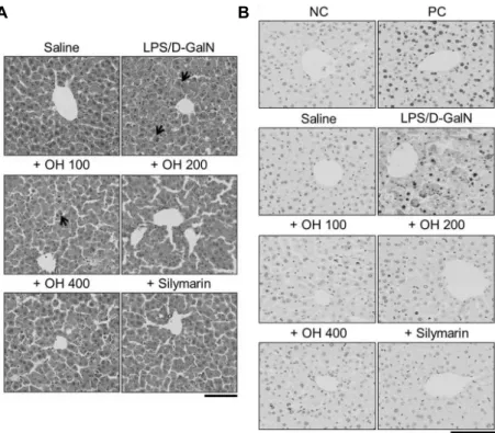 Fig. 3. Inhibitory effect of OH on histopathological changes and apoptosis in liver tissue obtained from acute liver injury mice