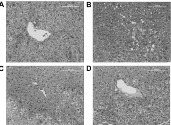 Fig. 2. Histopathological examination of mouse liver fed a liquid  diet with ethanol or ethanol plus A