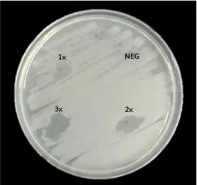 Fig.  2.  The  antimicrobial  activity  on  various  concentration  of  Cichorium  intybus  L