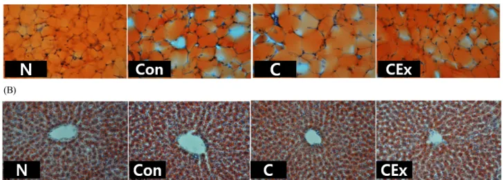 Fig. 1.  The  effect  of  L.  acidophilus  C  and  its  complexes  on  size  of  epididymal  adipocyte  (A)  and  lipid  droplets  of  liver  tissue  (B)  in  high  fat  diet  fed  mice  for  6  weeks