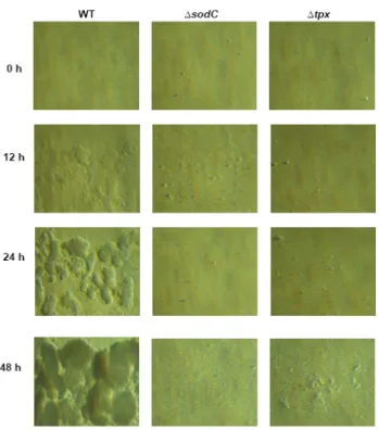 Fig. 2.  Quantification  of  EHEH  O157:H7  biofilm  formation  using  glass  capillary  tubes  and  a  continuous  flow  system