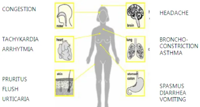 Fig. 2.  Various  serious  symptom  of  human  contaminated  from  biogenic  amines  (Naila  et  al.,  2010)