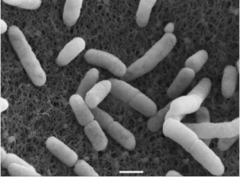 Table 4. Characterization of EHEC bacteria, O104:H4 outbreak strain in Germany Virulence 