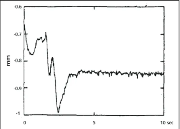 Fig.  1  Tracking  Error  of  Tip  Position