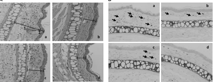 Fig. 7. Photomicrograph of transverse sections of mice ears sensitized with topical application of 5% croton oil (v/v) in acetone  (a-c) or vehicle acetone (d, non-inflamed), stained with hematoxylin-eosin (A) and toluidine-blue (B) examined under light mi