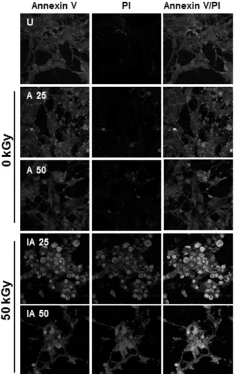Fig. 6. Visualizing confocal microscopy test of apoptosis in the  non-small cell lung carcinoma (H1975) cell