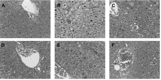Fig. 3. Effect of Dendropanax morbifera leaf extracts on SOD activity. Sample are the same as Table 2