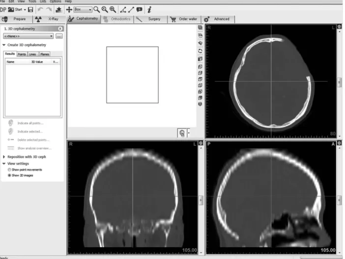 Fig. 1. Preoperative CT scan.