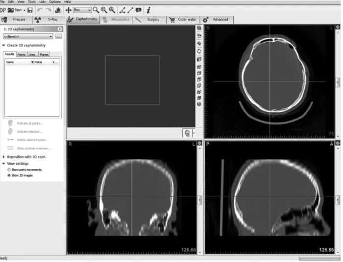 Fig. 3. Postoperative picture.
