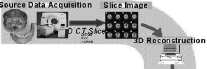 Fig. 1. Sequence of computer processing of 3D CT scan data.