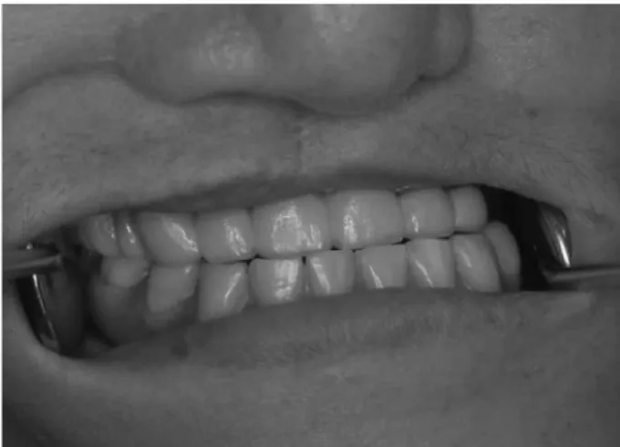 Fig. 10. Definitive prosthetic restoration.