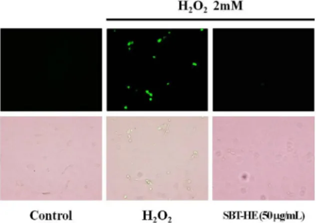 Fig. 8. Protective effects of fermented sea buckthorn leaves with H. erinaceum mycelium (SBT-HE) on the generation of ROS  induced by H 2 O 2 