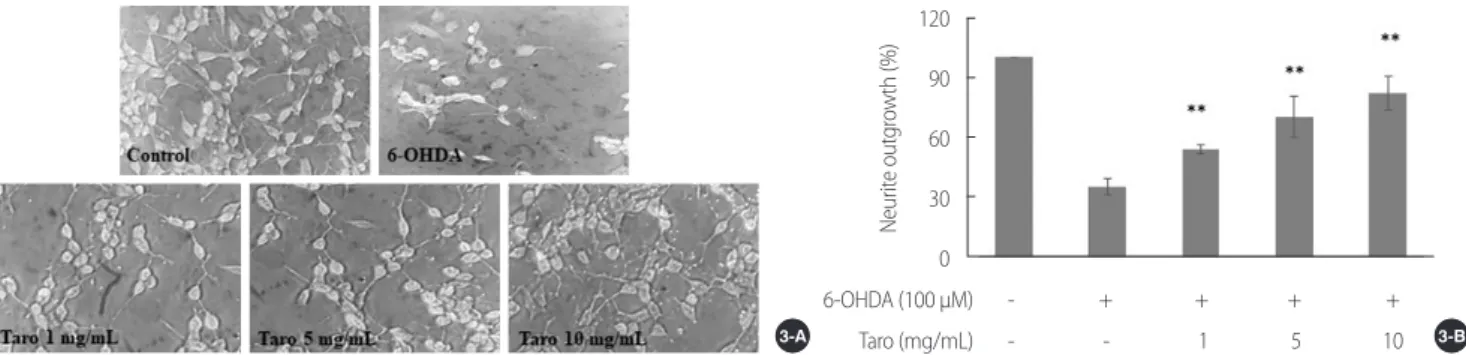 Figure 3. Neurite outgrowth&amp; neuronal differentiation were visualized under× 200 magnifications