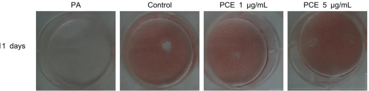 Fig. 3. Lipid accumulation in pine cone extracts treated 3T3-L1.