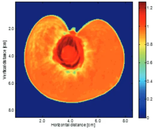 Fig.  1  CT  image  of  a  peach