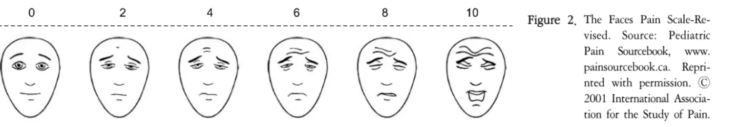 Figure  2.  The  Faces  Pain  Scale-Re- Scale-Re-vised.  Source:  Pediatric  Pain  Sourcebook,  www