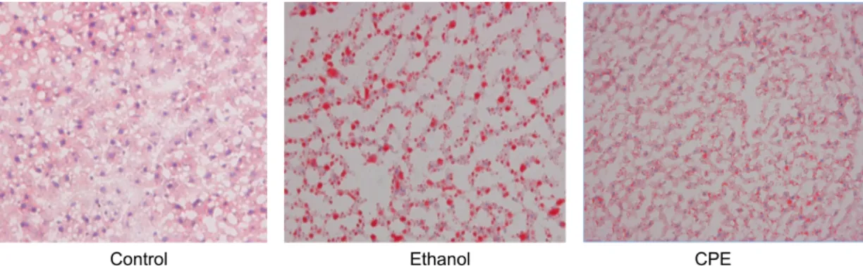Fig. 1. Liver histology of rats fed a diet containing either ethanol (ethanol) or ethanol plus citrus peel extract (CPE), compared with pair-fed controls (Hematoxylin &amp; Eosin stain, ×200)
