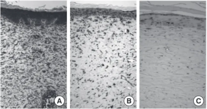Figure 3. (A) Immunostaining for VEGF of rat skin of pressure ulcer 4  weeks after wet gauze dressing