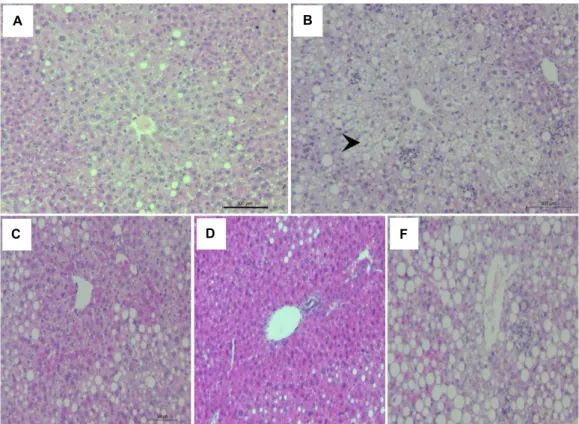 Fig. 1. Hematoxylin and eosin-stained photomicrographs showing the liver (×100). (A) normal control, (B) high fat group, (C) 1%  Lentinus edodes extract powder (LEP) group, (D) 3% LEP, (E) 5% LEP