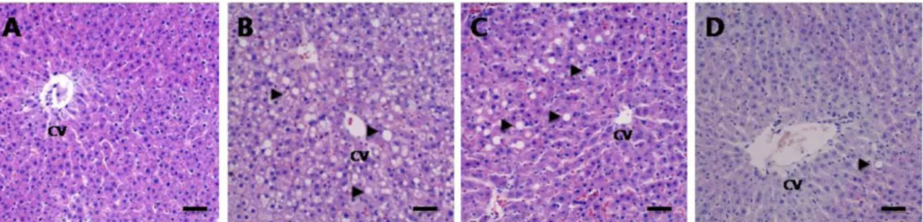 Table 1. Effect of Lindera erythrocarpa Makino crude extract on liver enzyme activity in obese rats 
