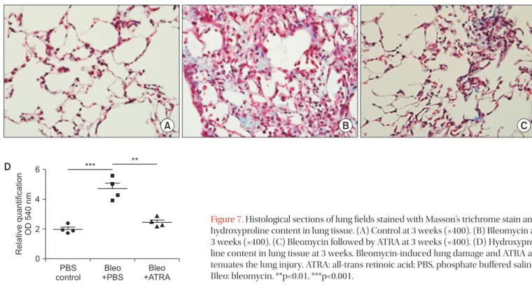 Figure 7. Histological sections of lung fields stained with Masson’s trichrome stain and  hydroxyproline content in lung tissue