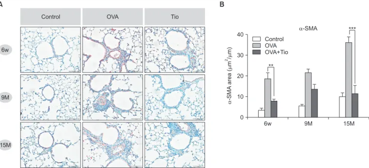 Figure 6. Effect of tiotropium bromide on smooth muscle hyperplasia in airway remodeling in a mouse model of chronic asthma with aging