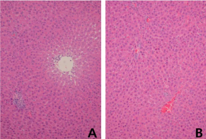 Fig. 3. (A) Mildly degenerative change around central venule  is noted in control group (H&amp;E, ×20)