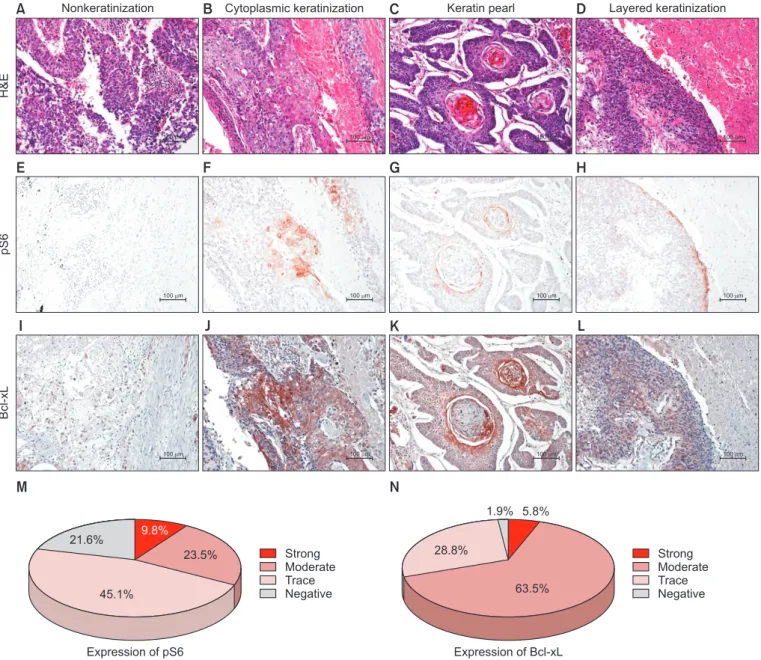 Figure 2. Relationship of keratinization (A–D, H&amp;E stain, ×200) with the expression of pS6 ribosomal protein (Ser235/236; E–H, ×200) and  Bcl-xL (I–L, ×200)