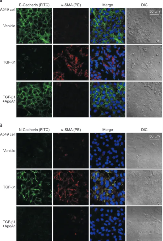 Figure 2. ApoA1 inhibits TGF-β1–in- TGF-β1–in-duced EMT in A549 cells. A549 cells were  treated with TGF-β1 (5 ng/mL) with or  without ApoA1 (100 ng/mL) for 48 hours