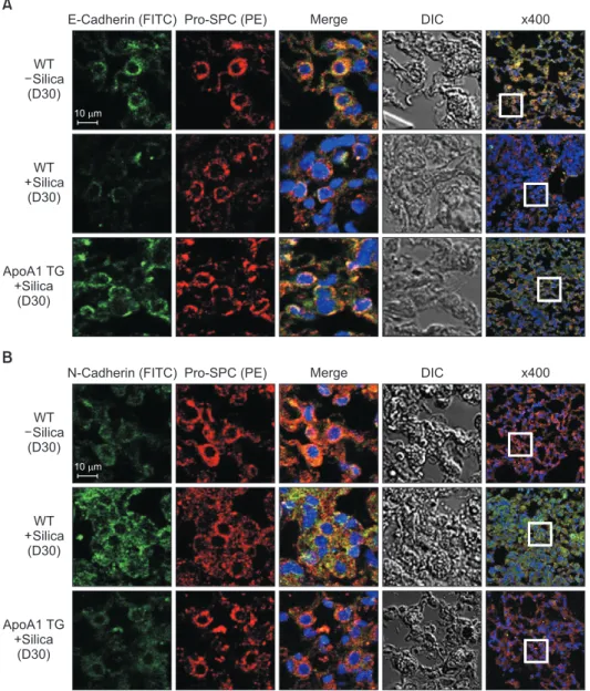 Figure 4. Overexpression of ApoA1 at- at-tenuates silica-induced EMT in the  mouse lung