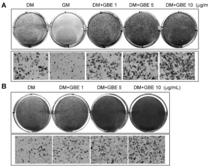 Fig. 2. GBE promotes adipocyte differentiation in  C3H10T1/2 and 3T3-L1 cells. (A) (top) C3H10T1/2 cells were treated with various GBE concentrations  (1, 5, and 10 μg/mL) and were induced to differentiate  for 5 days followed by Oil Red O staining