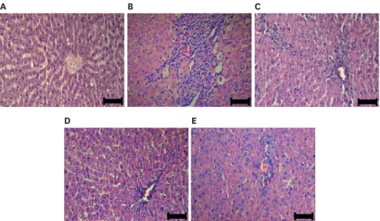 Fig. 5. Pathological observation (hematoxylin &amp; eosin) in liver tissue. Normal (A), Control (B), SM (C), ACL (D), and  ACH (E)