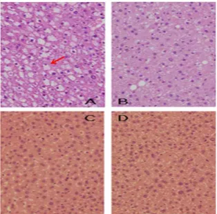 Fig. 6. Effect of the OF on 3-hydroxy-3-methylglutaryl- 3-hydroxy-3-methylglutaryl-coenzyme A reductase (HMG-CoA-R) (A), low density  lipo-protein receptor (LDL-R) (B) and cholesterol 7α-hydroxylase (CYP7A1) (C) mRNA expression