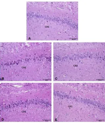 Fig. 3. The light micrographs of CA1 area from hippocampus.