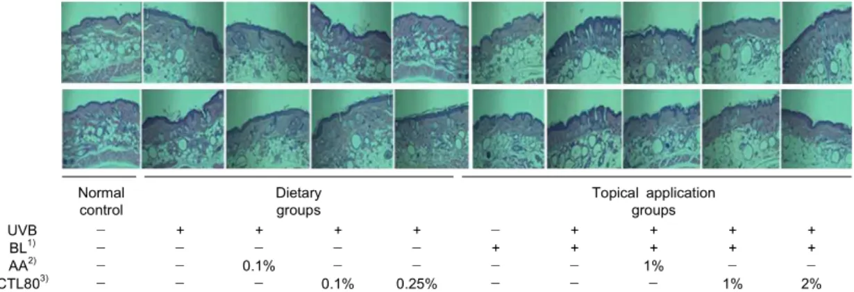 Fig. 2. Histological observation on UVB-induced hairless mice skin after 10 weeks experiment to evaluate the inhibitory effect of CTL80