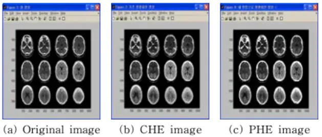 Fig.  5.  Histogram  equalization  results  of  200×247                            pixels  MRI-brain  medical  image.