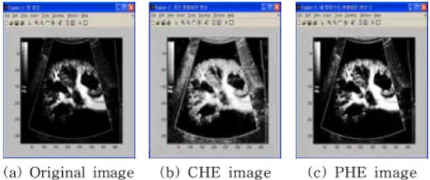 Table  1.  Equalization  time  by  changing  resolution  of                                    images             해상도 평활화기법 200*247 400*286 330*390 430*323 450*295 611*404 718*968 1024*768 CHE 0.20 0.41 0.47 0.48 0.50 0.77 2.34 2.55 PHE 0.22 0.42 0.50 0.55