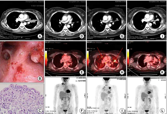 Figure  1.  Summary  from  the  initial  diagnostic  investigation  to  last  follow-up