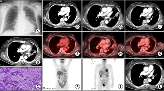 Figure  2.  Summary  from  the  initial  diagnostic  investigation  to  last  follow-up