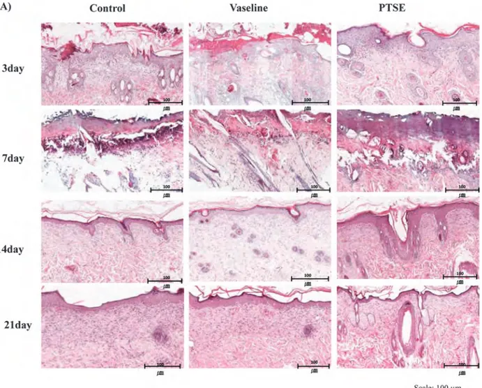 Figure 5. H&amp;E staining and immunohistochemistry for type 1 collagen fiber showing re-epithelialization with PTSE treatment on skin injury induced by laser radiation