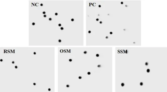Fig. 5. Comet images of human leukocytes. NC: negative  con-trol, PC: 200 μM H 2 O 2 -treated positive control, RSM: raw  shi-itake mushroom water extract 50 μ g/mL＋200 μM H 2 O 2 , OSM: