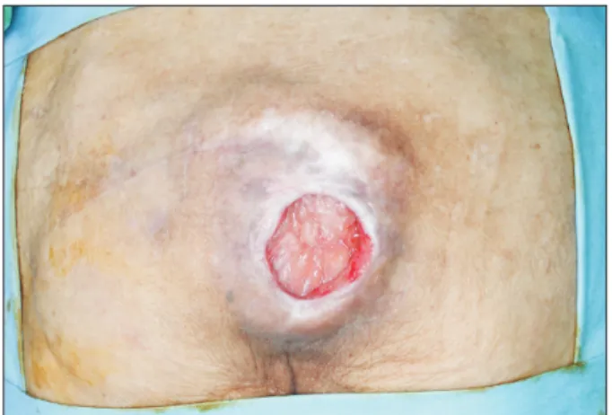 Fig. 5.  Preoperative photograph.