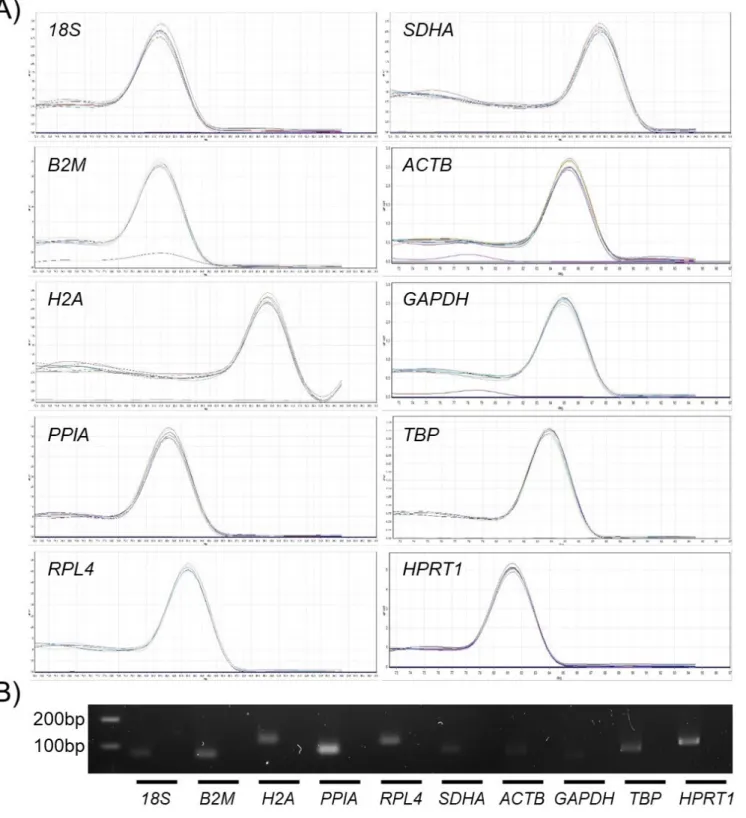 Figure 2.  Examination of primer specificity and amplicon size. (A) A high peak of single products without any nonspecific amplification was identified during melting curve 