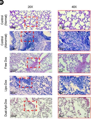 Fig. 7. Pathological changes of  lung organs in BCSC metastasis model treated with Dual-Apt-Dox