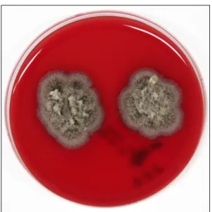 Figure  4.  Gray  colored  colonies  growing  on  Sabouraud dextrose  agar  after  incubation  for  14  days  at  30 o C.