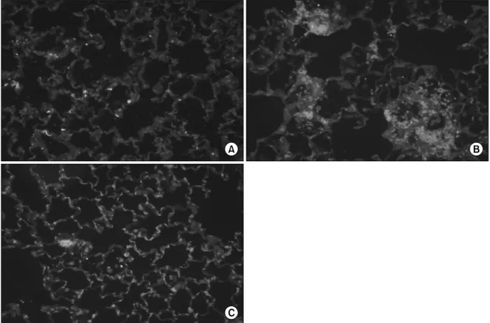 Figure  5.  (A)  A  fluorescent  immunohistochemistry  for  detection  of  secretory  phospholipase  A 2   (sPLA 2 )  in  the  normal rat's lung